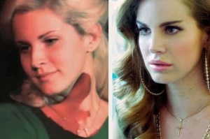 lana_del_rey-plastic-surgery-before-and-after